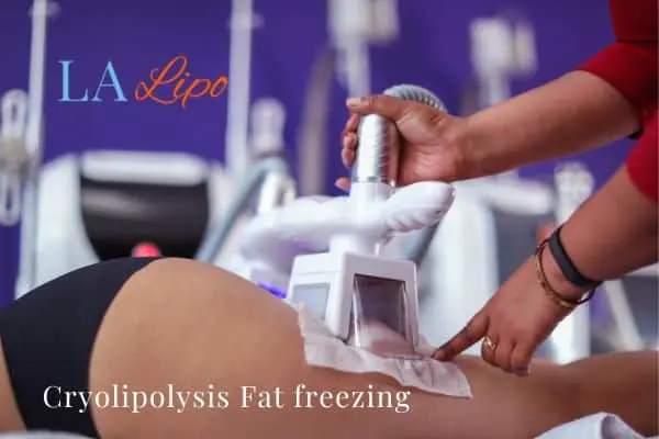 women getting fat freezing Willesden Green