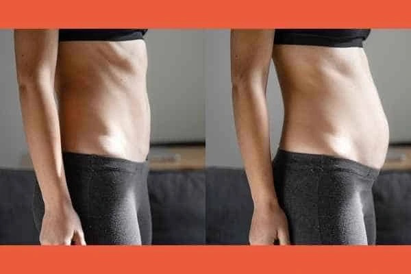 LA-EMS Body Sculpting results Willesden Green