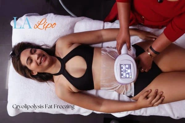 woman getting cryolipolysis Willesden Green