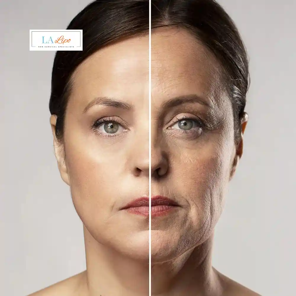 How Can You Tell If Non-Surgical Skin Tightening Is Right for You Willesden Green?
