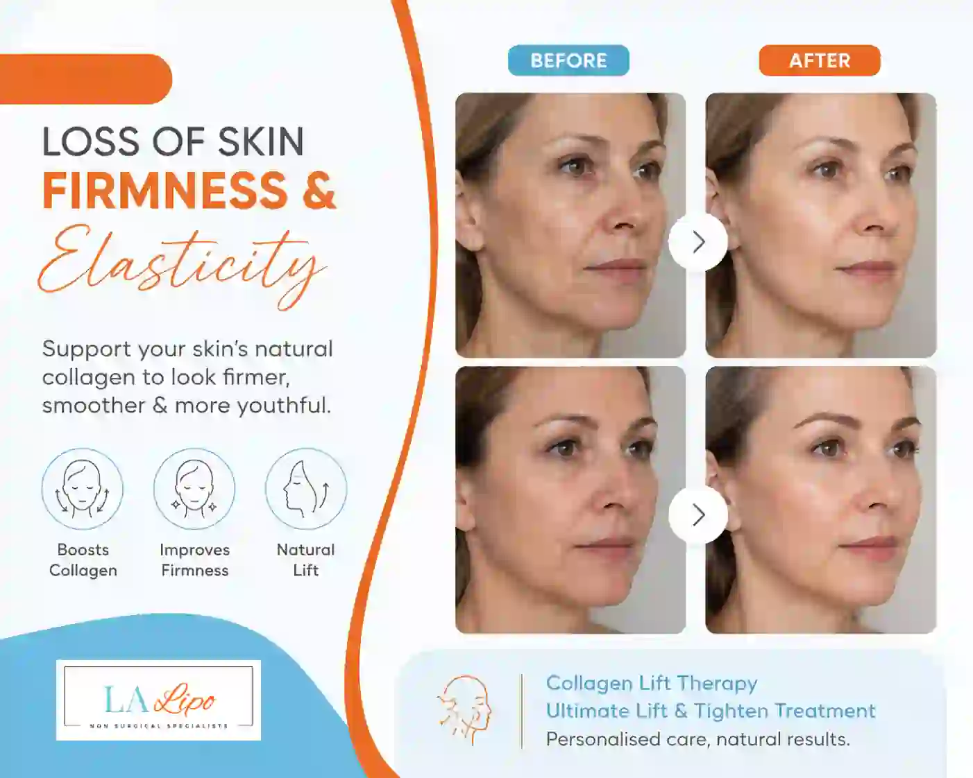 Sign #7: Loss of Skin Firmness and Elasticity Willesden Green